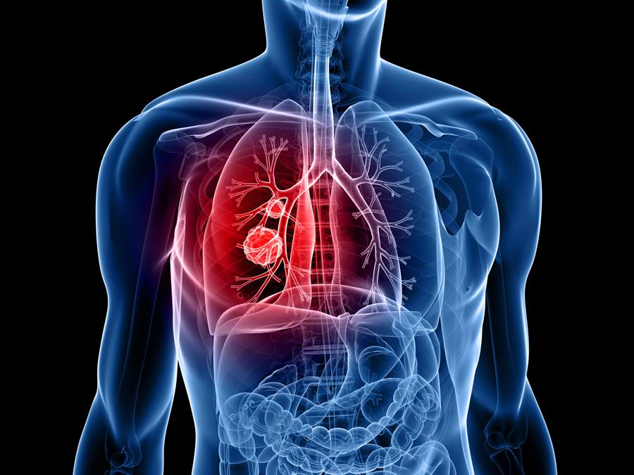 November 2025 Thoracic Surgery Newsletter