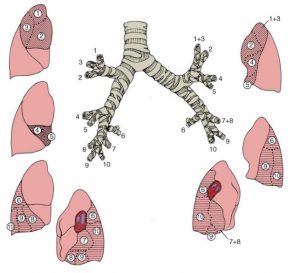 EBUS - Dr. Min Kim | Thoracic Surgeon Houston Texas